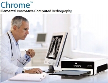 Hệ thống nâng cấp X-quang kỹ thuật số CR iCRco Chrome